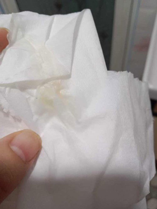 ตกขาวหรือมูก: