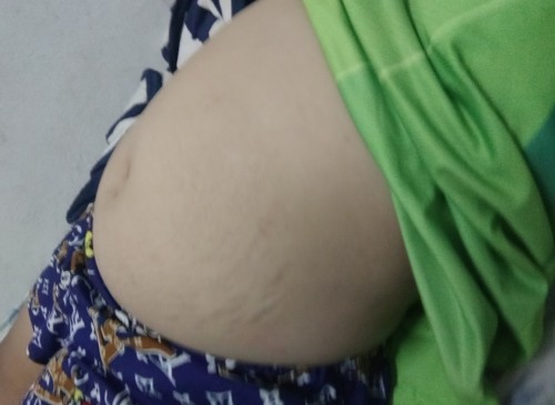 แม่ๆว่าท้องเราใหญ่เกินไปไหมค่ะประจำเดือนขาดไปเดือนกว่าตรวจแล้วขึ้น1ขีดค่ะเดินไปไหนมีแต่คนทักว่าท้อง