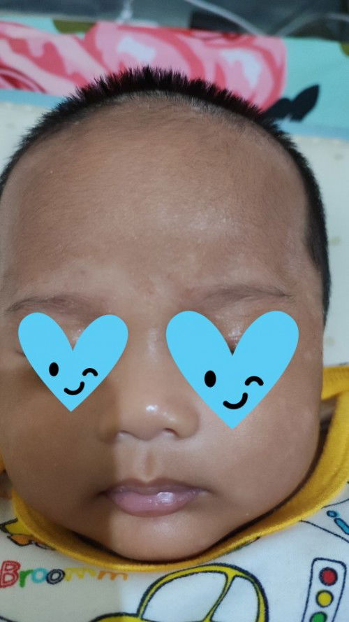 Hallo,ada yg wajah anaknya begini ga? Babyku usia 2bln wajahnya begini, pake apa ya biar ilang ,