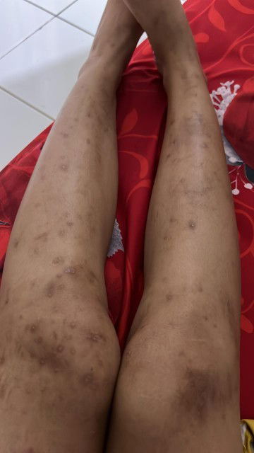 Gatel gatel saat hamil