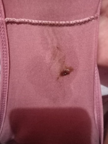 38 weeks and 6days... Mucus Plug