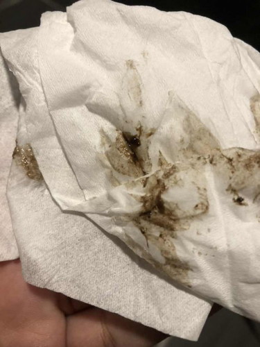 กระตุ้นปากมดลูก 38+4