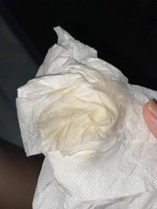 แม่ๆคะ สอบถามหน่อยค่ะ ตั้งครรภ์21week พอดีจามแล้วมีน้ำแบบนี้ออกมา ผิดปกติมั้ยคะ