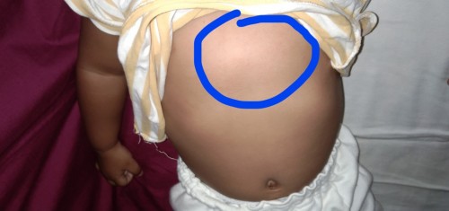 Malaki ang dibdib ng baby ko