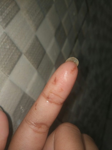 Usia kandungan ku 7w1d tp keluar cairan kya gt Bun warna coklat kemerahan share pengalaman dong bun