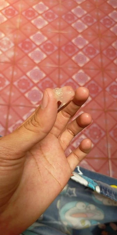 สอบถามแม่ๆหน่อยค่าเมื่อคืนเจ้บท้องเเต่เจ้บแบบทนได้แล้วก็หาย พอมาเมื่อเช้ามีมูกแบบนี้ออกมา 39+5