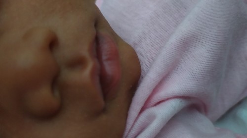 Bun mau tanya anak saya umur 1 bulan lebih bibirnya hitam bagian kiri kanan ini bahaya ga ya bun