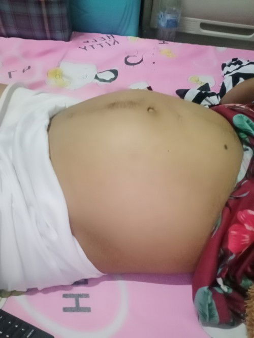 Normàl lang Po ba na maliit Ang tyan ko I'm 8 months pregnant po at lagi na Po syang naninigas