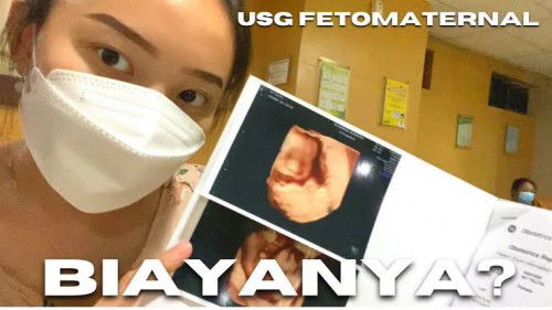 USG Fetomaternal