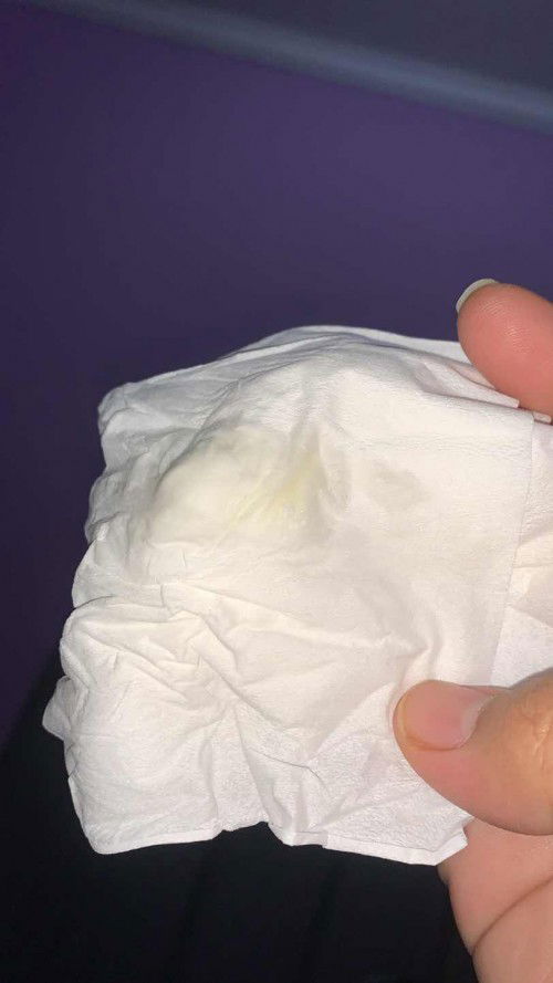 Ketuban atau keputihan ?