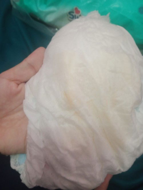 Pipis bayi sedikit dan ada warna orange