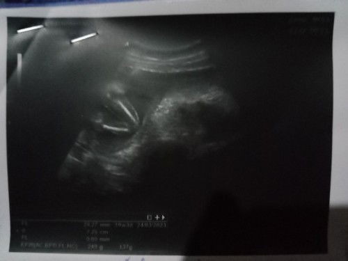 อัตราซาวด์