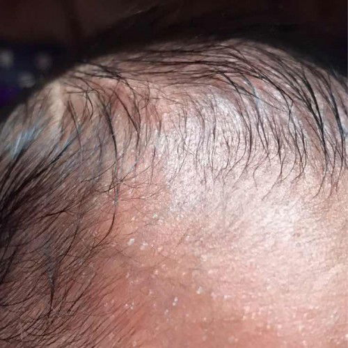 Ruam baby bantu jawab ya mom