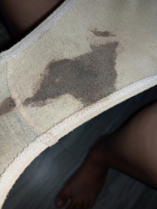 black discharge in 37weeks