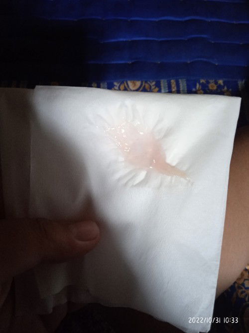 Mlm minggu merasakan kontraksi hebat tapi pagi nya hilang, lalu hari senin keluar lendir ini,