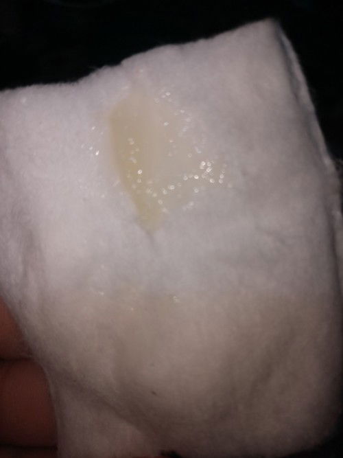 ตกขาวว่ามูกค่ะ