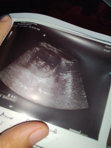 Baby 11 week