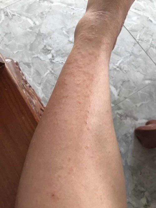 Xin ý kiến các mom