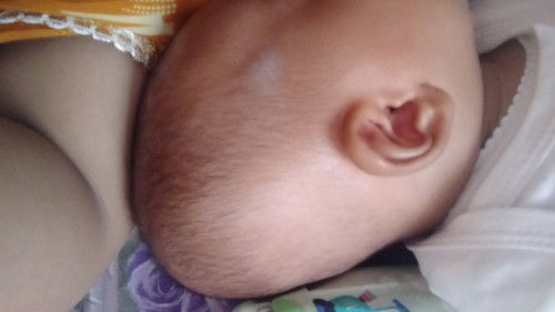 Kepala bayi peyang