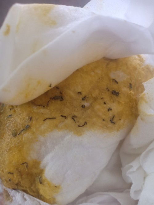 ขอโทษค่ะลูกอึแบบนี้ผิดปกติไหม มีเส้นดำๆแบบนี้ออกมาเยอะมากค่ะ