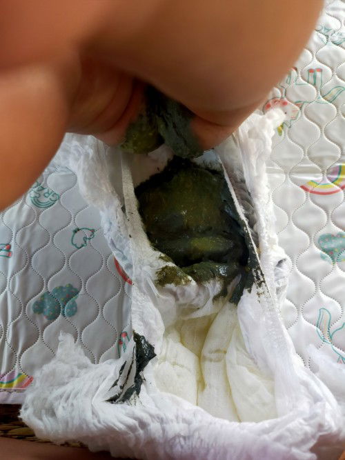 การขับถ่าย