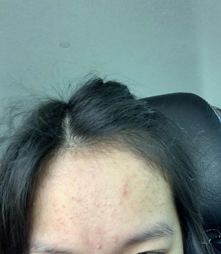 Skincare for preggy