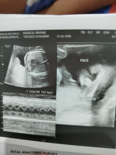 Baby Gender