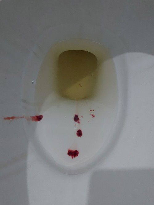 Keluar bercak darah