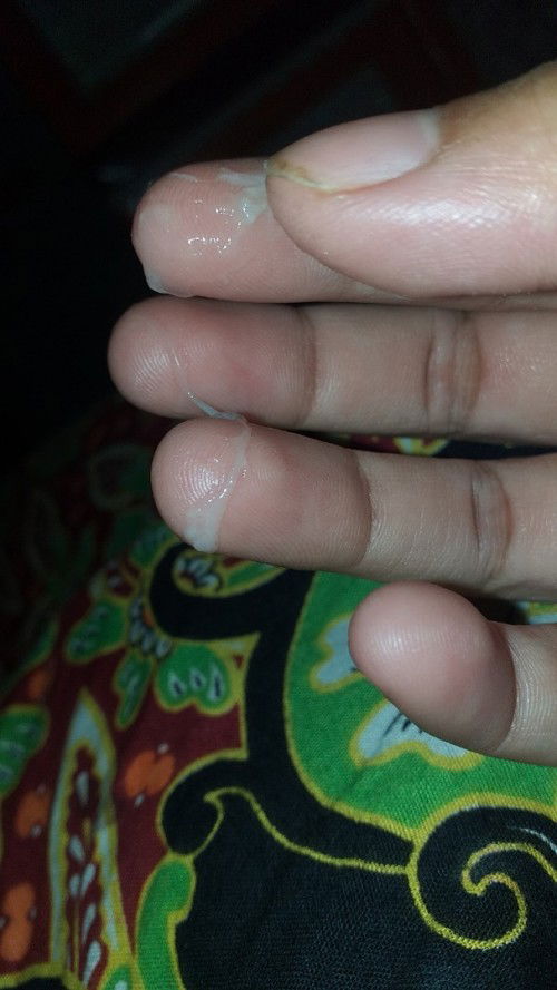 ini knpa ya bun mohon info yh donk,uk baru 35 minggu wajarkah