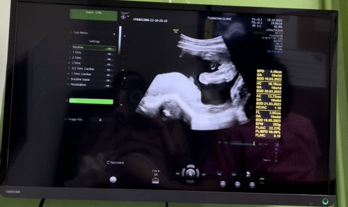 น้อง 19 W 6 D จ้า