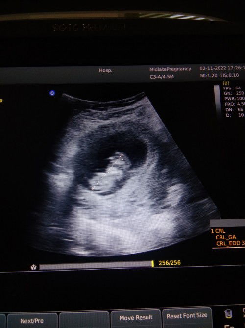 Hpht 16 agust perhitungan 11w bidan bilang 10w