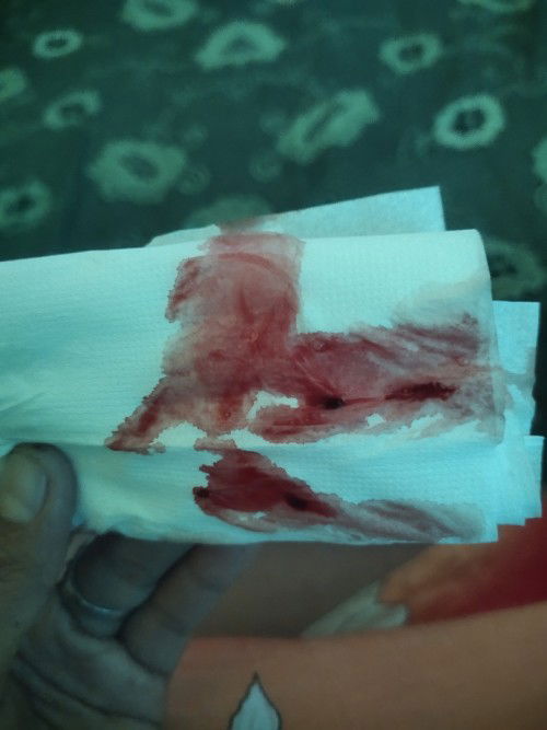 Keluar darah dari hari senin sampai hari kamis/sekarang.