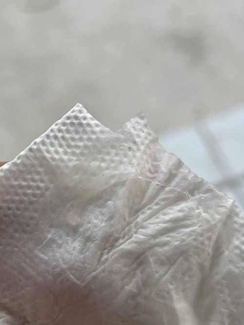 มูกใส หรือ ตกขาว