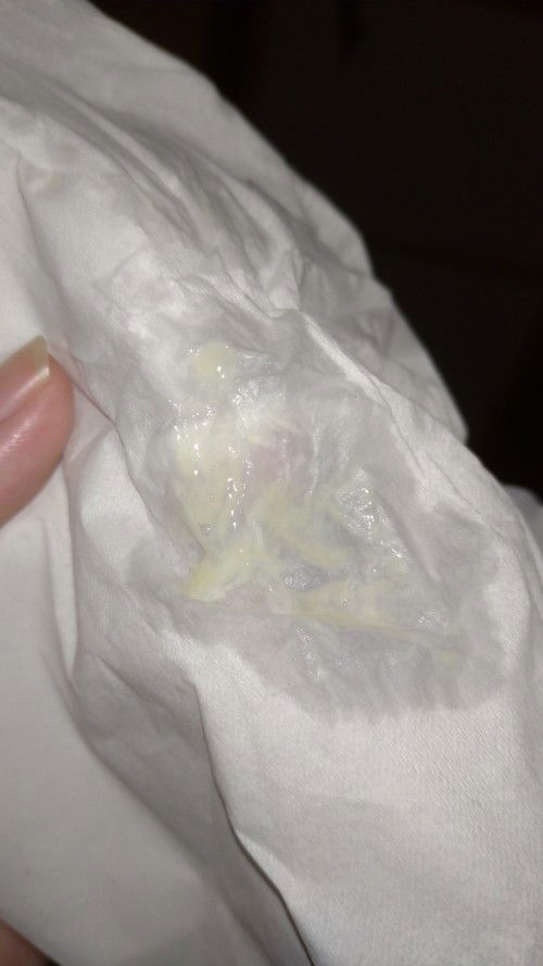 Keputihan atau lendir?