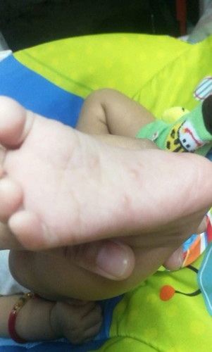 Hi mga mommies tanong ko lang ano maganda ipanggamot dito at panglinis ng bahay gawa ng scabies