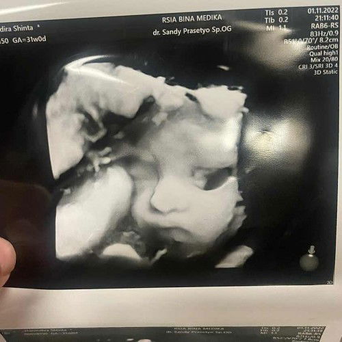 Akhirnya anakku ga ngumpet lagiii😍🤍