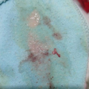 Kenpa ya? Hamil 22week