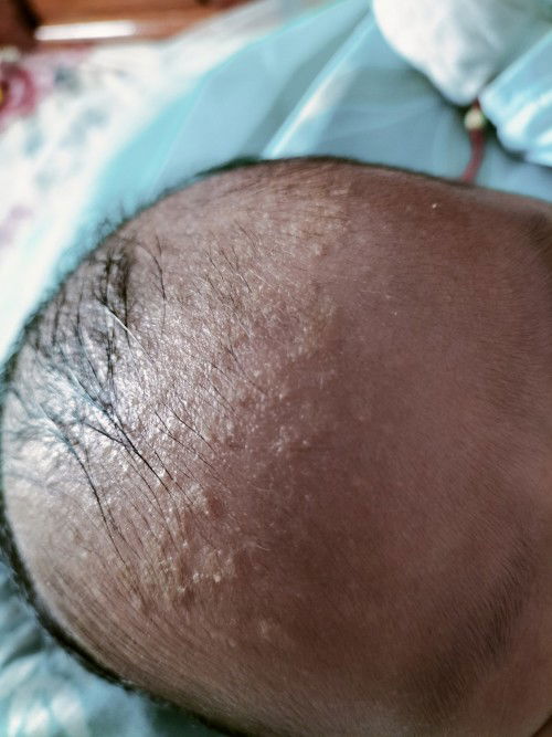 Trang con e bị sao v các mom