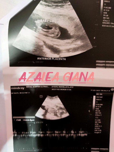 hello po team march
19 weeks and 4 days po baby girl po