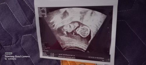 13 week keluar darah seger