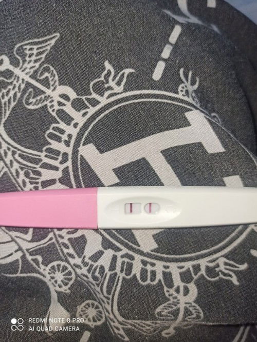 Usg usia 5 minggu belum kelihatan apa apa