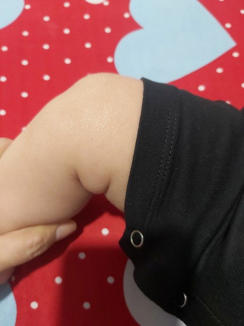 Có mom nào có bé 4 tháng tuổi ,da bị sần, khô giống con e không? Chỉ cách nào giúp em với mọi người