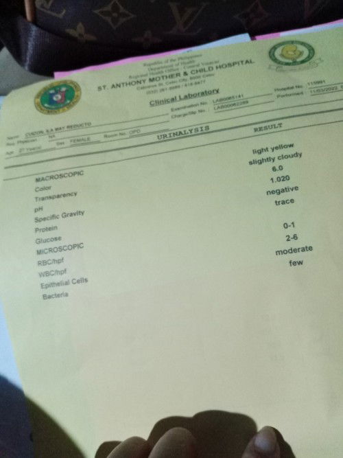 Urinalysis Result