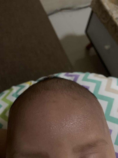 Bayi sering keringetan