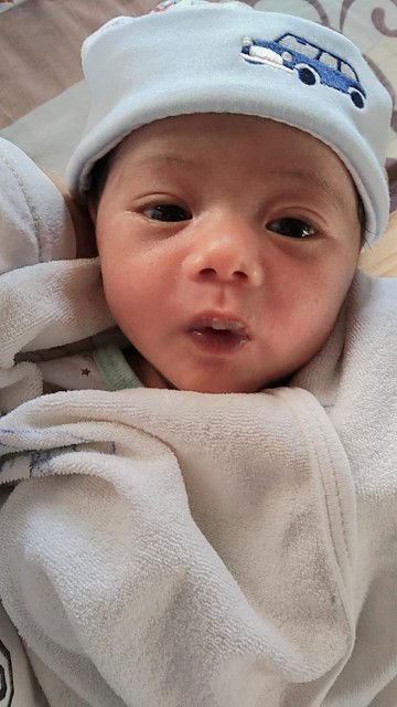 ลูก14วันถ่ายบ่อย