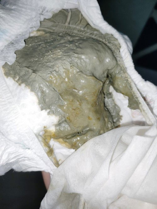 Najis baby dua bulan