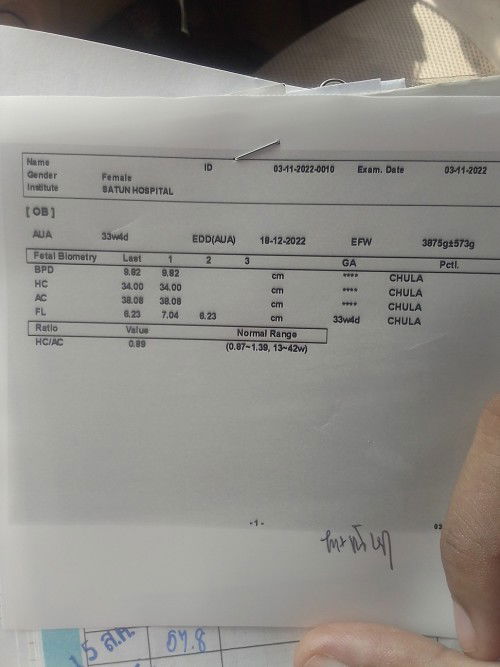 39w3d วันนี้แม่รู้สึกน้องไม่ค่อยดิ้น ดิ้นเบาๆ ช่วงเช้าแม่มีอาการปวดท้องปวดหลังลงก้น และท้องแข็ง