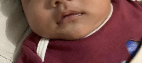 Need advice po. First time mom here. 
Di ko alam anong nangyari kay LO.