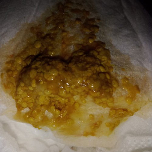 normal atau bermasalah najis baby saya ni ya mom ?