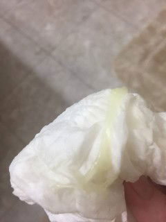 Discharge 3months after giving birt